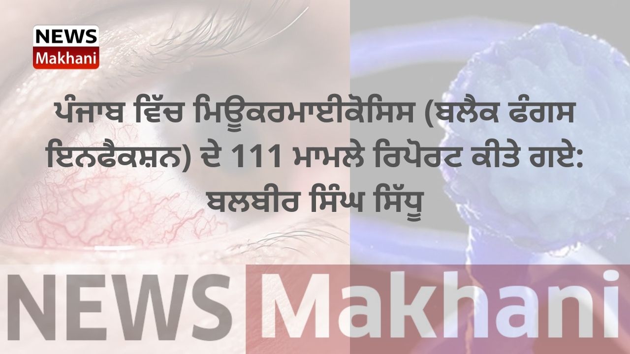 ਪੰਜਾਬ ਵਿੱਚ ਮਿਊਕਰਮਾਈਕੋਸਿਸ (ਬਲੈਕ ਫੰਗਸ ਇਨਫੈਕਸ਼ਨ) ਦੇ 111 ਮਾਮਲੇ ਰਿਪੋਰਟ ਕੀਤੇ ਗਏ ਬਲਬੀਰ ਸਿੰਘ ਸਿੱਧੂ