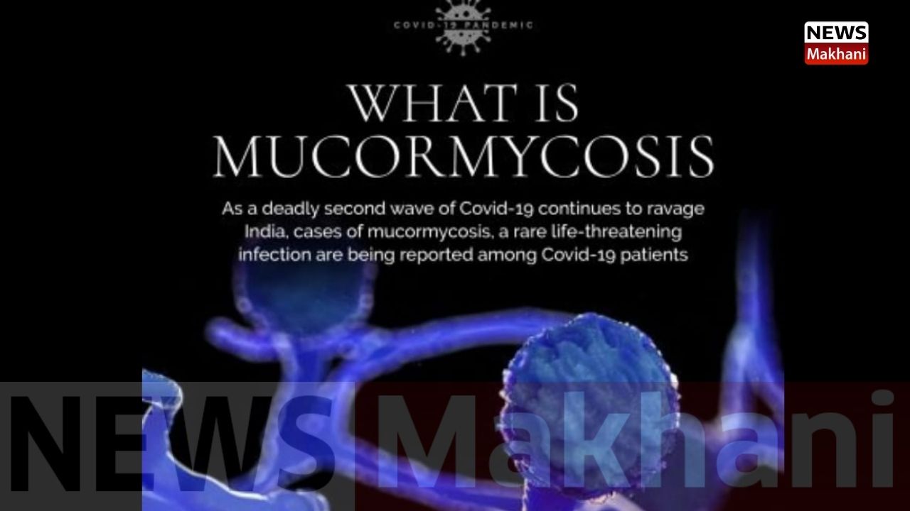 Mucormycosis1