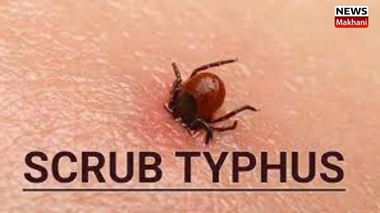 scrub typhus11