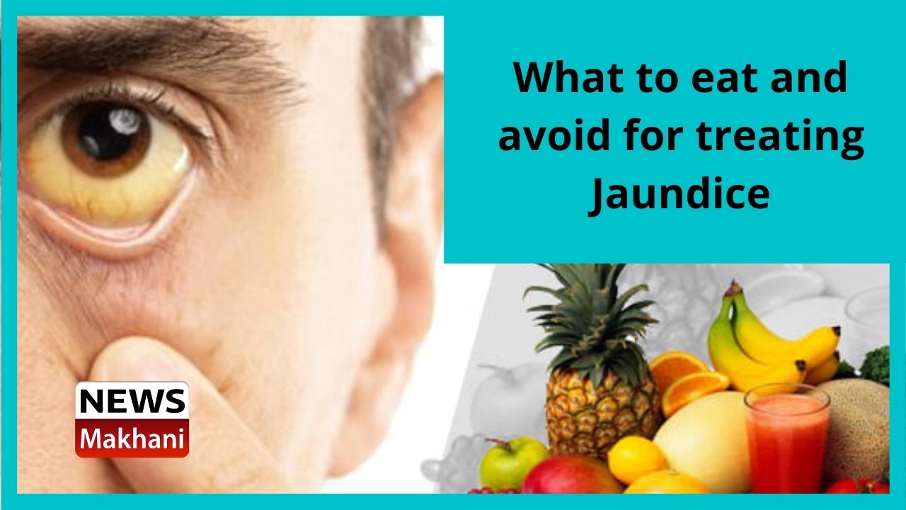 What to eat and avoid for treating Jaundice