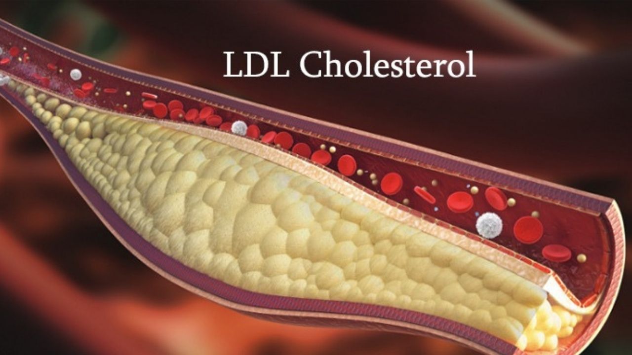 All you need to know about LDL or ‘Bad’ cholesterol
