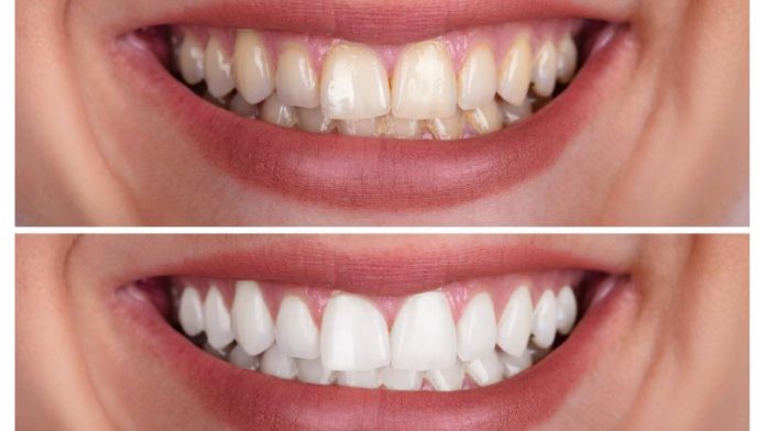 Untitled design - 2023-08-12T174329.462